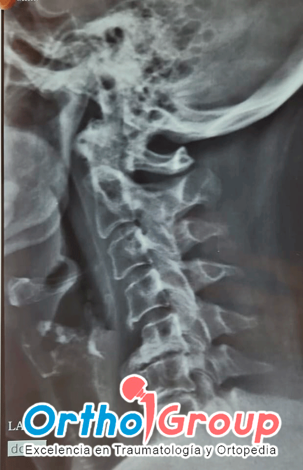 orthogroup-COLUMNA-REHABILITACION-Ortopedia-Rehabilitacion-Traumatologia